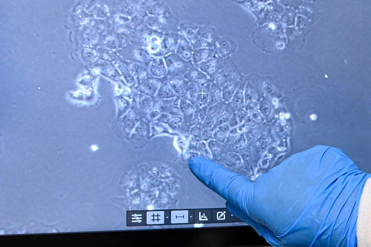 AI detects pancreatic cancer up to 3 years before diagnosis, outperforms radiologists in landmark study
