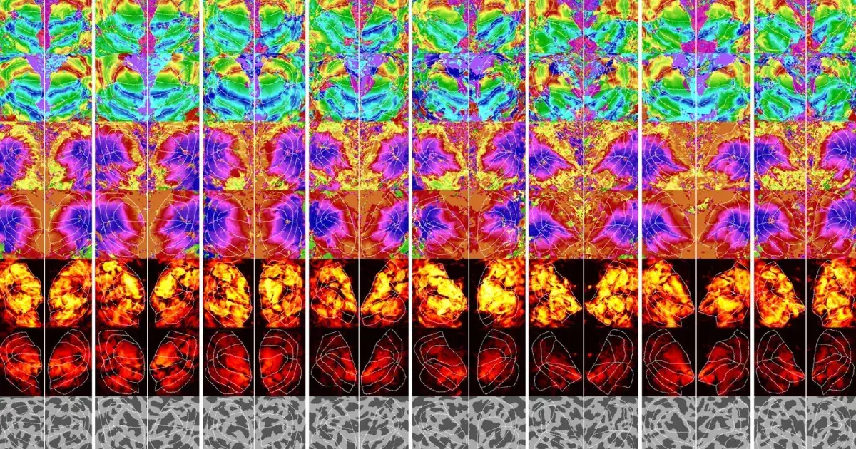 New AI Model Reads Brain Scans to Reconstruct Images With Unprecedented Speed and Accuracy